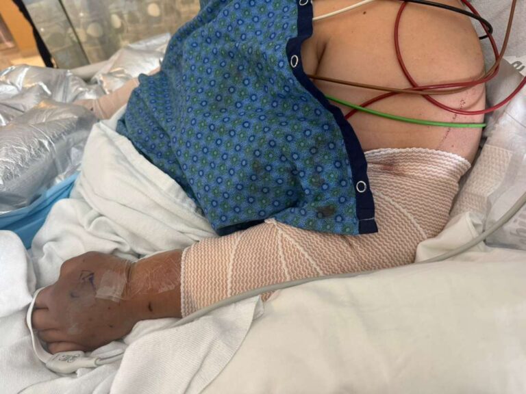Mujer en estado crítico tras brutal ataque de perros en Aurora