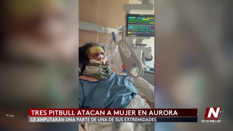 Ataque De Perros En Aurora Deja Mujer En Estado Crítico