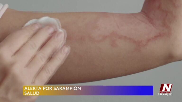 Autoridades Alertan Por Aumento De Casos De Sarampión En Colorado